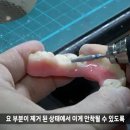 날개치과기공소 이미지