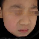 셀렉트피부과의원 네이버블로그
