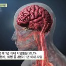 [무엇이든 팩트체크] 1)눈에 핏발 서면 고혈압일 수 있다? 2)제기차기 하면 균형감각 높아진다? 3)하지정맥류 관리에 족욕이... 이미지