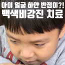 무지개연합의원 | 아이 얼굴 하얀반점 유아 백색비강진 진료 후기