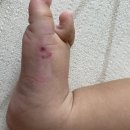 투비메드 이미지