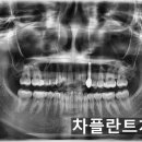차플란트치과의원 이미지
