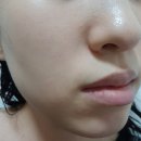 더블유에스메디컬 | 마스크팩추천 수분충전마스크 에스지엔 호스메티카 더블유 포 화이트닝 마스크 팩으로 1일1팩 후기