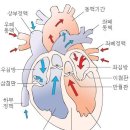 심장판막 질환과 치유 이미지