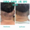 아로모탈모두피클리닉 | 제주두피관리 헤드스파 탈모관리 아로모탈모두피클리닉