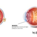 에실로안경원 네이버블로그