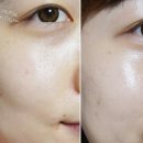 러블리페이스스킨케어 이미지