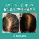 당리동-20 | 부산 여성탈모 20회만에 개선된 리얼후기/당리동 탈모센터 '다나두피'