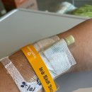 뇌머리식당 | 뇌종양(성상세포종 3등급, 악성) 이야기3