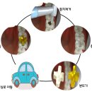 예스치과기공소 이미지