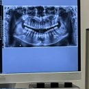 바른치과 | 대구 교정 내돈내산 상담 후기 (서울바른치과, 서울범어치과)