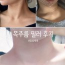 라라약국 | [뷰티] 라라플랜 목 주름 필러 후기💗