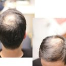 도시디자인 퍼실리테이션과정 | 검단신도시남자펌잘하미용실 리안헤어 범조타운점 방문 후기