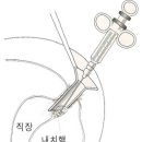 예항맥외과 | 치질수술 잘 하는 병원 서울항맥외과