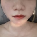 [서면] 서면윤곽관리 전문점 ‘비단숲에스테틱’ 솔직후기