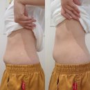 다일라 | 부산 양정 연산 시청 근처 에스테틱 추천 복부 순환관리 체질 개선 다일라 에스테틱
