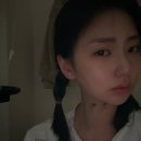 안산 고려대학병원 [편도제거 수술] 수술하는 날