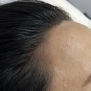 스칼프랩앤뷰티 네이버블로그