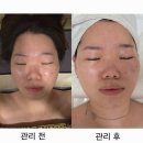 미드림 | [구미피부관리샵] 피부 트러블 잡는 구미에스테틱 미드림에스테틱 솔직후기💆🏻‍♀️✨