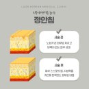 동구열관리