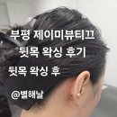 GS25부평사랑점 | 부평 왁싱 &lt;제이미뷰티끄&gt; 뒷목 왁싱 후기 머리집게로 똥머리하고 시원한 여름 즐기기🧊