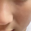 PCK | 블랙헤드 없는 매끈한 피부 DPS 디피에스 벌춰마스크 여드름팩 사용후기