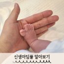 딤플뜻 신생아 엉덩이보조개 생후18일 아기 초음파 후기
