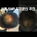 닷츠 | 광진구 건대 SMP 두피문신 전문 닷츠 추천 내돈내산 후기