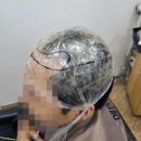 윤지영헤어 | 부산 덕천동 남자 맞춤가발 30대 활동적인 남성 고정식 가발 머리 밀지 않고 시원하게