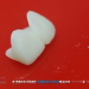 우리치아 치과기공소 이미지