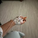 우면산6-1-7 | EP6 | 효성병원 제왕절개 6박 7일 후기(1인실 온돌방/비용/수술일자별 타임라인/유축/붓기/통증...