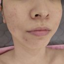 내외동피부관리 내동피부관리샵 예쁨주의보 물방울재생관리 수분뿜뿜 스킨케어 후기