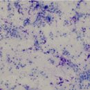 동물의료센터24인치 | 고양이 담낭 수술 : 담도폐색을 해결하기까지 영등포동물병원 동물의료센터24인치