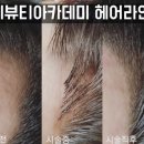 티뷰티아카데미