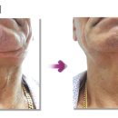 이프네 스킨앤바디 이미지