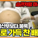 “증상이 시작되면 이미 늦었다” 조용히 굳어가는 간. 굳어버린 간은 돌아오지 않는다│명의│#EBS건강 이미지