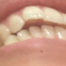 클래스원치과의원 이미지