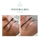 70년 전통, 독일 에스테틱 브랜드 구루버 [GRUBER] | 후기 사진