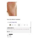 보고 발관리