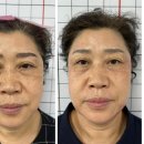 안산고잔동피부관리 아이백눈가주름,탄력관리 &lt;메리미뷰티&gt;
