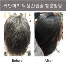 광주화정동극손상모 악성반곱슬 폭탄머리 루비클리닉매직 솔루션