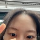 김안과 화장실 | ㅈㅇㅅ안과 김무연 원장님 내돈내산 렌즈삽입 1년후기