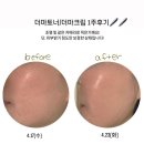 체험단 후기) 바이멜 데일리 토너 크림_1주차 솔직 후기