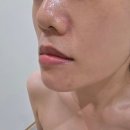 광주118 | 경기광주 에스테틱 태전동 엘덤에스테틱 모공 및 수분 관리 후기