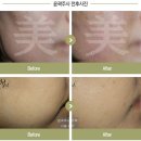 리더스미의원 네이버블로그