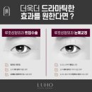 루호성형외과의원 이미지