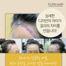 미미헤어라인 이미지