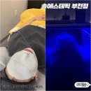 에스테틱솔루션 | 부천여드름전문 솔에스테틱 부천점 여드름솔루션케어 후기