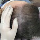 편안해서 좋았어요 우리 엄마의 새로운 변신 분당두피관리 위너뷰티