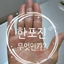 다한증&amp;한포진 면역력저하문제로 인해 심해진 것이다! (병원소개)